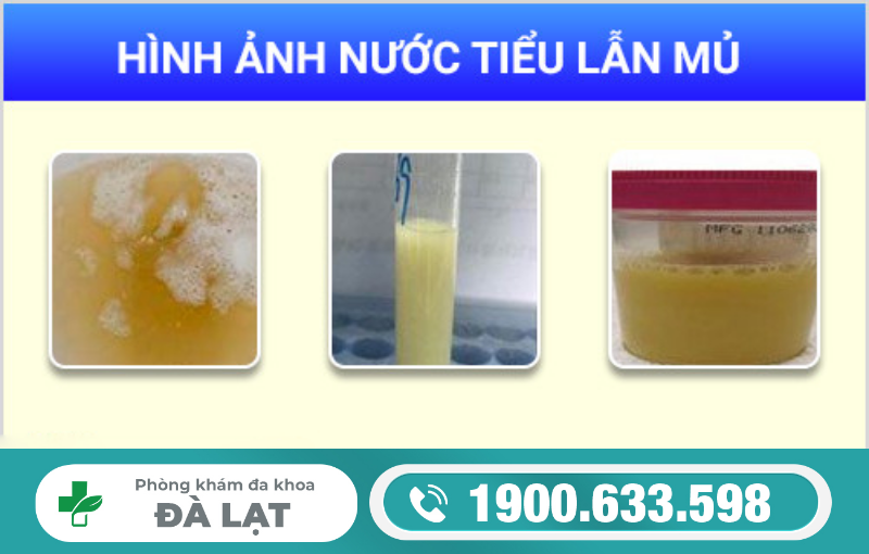 Hình ảnh minh họa